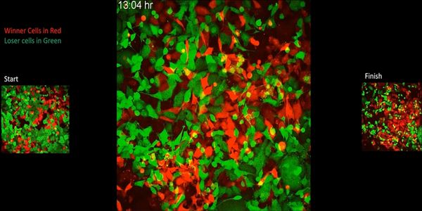 Red and green tumor cells